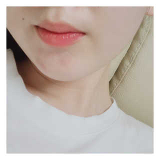 엘라밴드 하이드로 도트 스팟패치 12mm, 10mm — 5점을 준 리뷰어가 2020년 8월 올린 사용 사진