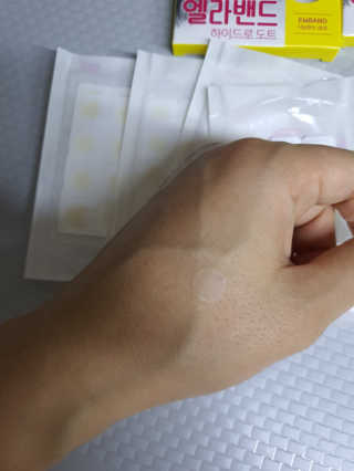 엘라밴드 하이드로 도트 스팟패치 12mm, 10mm — 4점을 준 리뷰어가 2020년 9월 올린 사용 사진