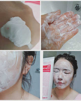 메디필 에스테 더마 유산균 콜라겐 클리어 — 5점을 준 리뷰어가 2020년 5월 올린 사용 사진