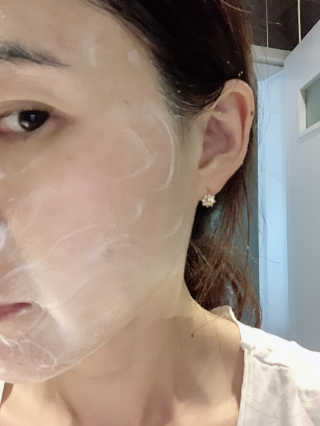 메디필 에스테 더마 유산균 콜라겐 클리어 — 3.5점을 준 리뷰어가 2020년 5월 올린 사용 사진