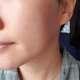 냉장고에 넣어요, 붉은 트러블 피부 다음날 진정되요 [버진팜스 푸딩수딩아토] — 5점을 준 리뷰어가 2020년 9월 올린 사용 사진