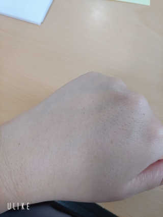 [후르디아] 혼합자차 선 에센스+톤업 선크림 2종 — 4점을 준 리뷰어가 2020년 5월 올린 사용 사진