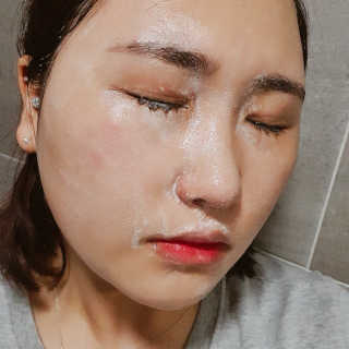 메디필 에스테 더마 유산균 콜라겐 클리어 — 5점을 준 리뷰어가 2020년 7월 올린 사용 사진