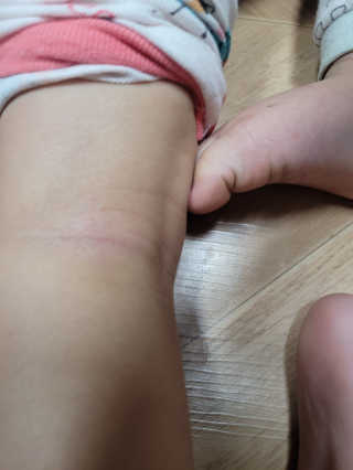 아토스탠다드 베이비크림 — 5점을 준 리뷰어가 2020년 12월 올린 사용 사진