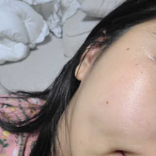 메디필 레드 락토 콜라겐 앰플 — 5점을 준 리뷰어가 2020년 11월 올린 사용 사진