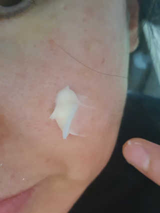 메디페르 [ 1+1 ] 루테인앰플세트 1개 + 루테인크림 50ml 1개 — 5점을 준 리뷰어가 2020년 9월 올린 사용 사진