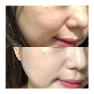 세렌디뷰티 레드 프로폴리스 모이스처 트리플 쿠션 — 4.5점을 준 리뷰어가 2020년 8월 올린 사용 사진