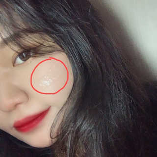 냉장고에 넣어요, 붉은 트러블 피부 다음날 진정되요 [버진팜스 푸딩수딩아토] — 5점을 준 리뷰어가 2020년 9월 올린 사용 사진