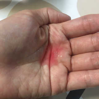어글리프루프 에센스 스탑디어글리 레드모먼트 에센스 120ml — 5점을 준 리뷰어가 2020년 8월 올린 사용 사진