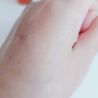 메디페르 [ 1+1 ] 루테인앰플세트 1개 + 루테인크림 50ml 1개 — 5점을 준 리뷰어가 2020년 10월 올린 사용 사진