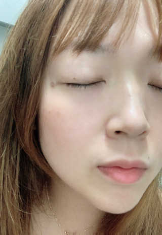 닥터존스킨 눈썹자라 — 4점을 준 리뷰어가 2020년 8월 올린 사용 사진