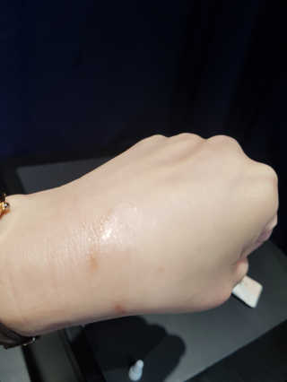 derma SC-Gel 더마에스씨 겔 20g — 4점을 준 리뷰어가 2020년 4월 올린 사용 사진