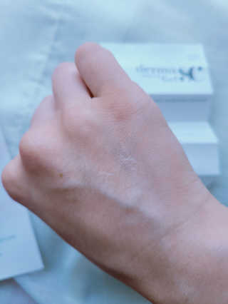 derma SC-Gel 더마에스씨 겔 20g — 4점을 준 리뷰어가 2020년 5월 올린 사용 사진