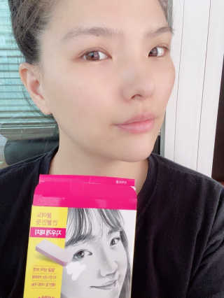 엘라밴드 하이드로 도트 스팟패치 12mm, 티트리 — 5점을 준 리뷰어가 2020년 8월 올린 사용 사진