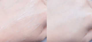 derma SC-Gel 더마에스씨 겔 20g — 5점을 준 리뷰어가 2020년 4월 올린 사용 사진