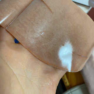아이디플라코스메틱 아이디 페이스핏 마이너스 밴드 — 4점을 준 리뷰어가 2020년 4월 올린 사용 사진