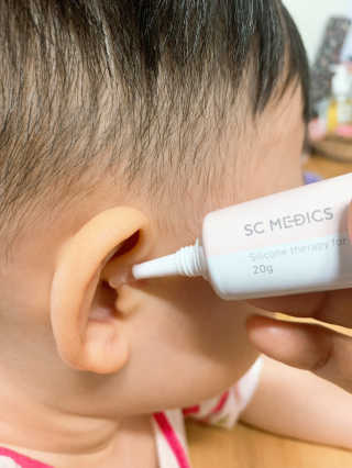 derma SC-Gel 더마에스씨 겔 20g — 4점을 준 리뷰어가 2020년 5월 올린 사용 사진