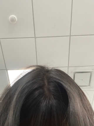 리더스코스메틱 리더스 헤어 라피 헤어 로스 컨트롤 토닉 — 4.5점을 준 리뷰어가 2020년 4월 올린 사용 사진