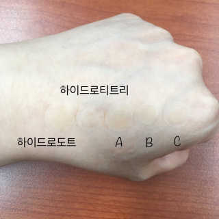 엘라밴드 하이드로 도트 스팟패치 12mm, 티트리 — 3.5점을 준 리뷰어가 2020년 8월 올린 사용 사진