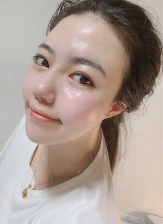 메디필 블루 아쿠아 톡스 크림 — 5점을 준 리뷰어가 2020년 8월 올린 사용 사진