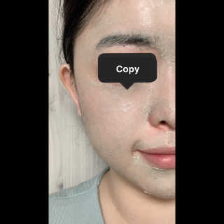 천사연구소 진짜 生병풀잎을 그대로  갈아 넣은 워시오프 센텔라팩 — 5점을 준 리뷰어가 2020년 7월 올린 사용 사진