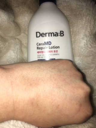 DR81Luvskin2much님이 올린 리뷰 사진 3
