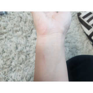 derma SC-Gel 더마에스씨 겔 20g — 4점을 준 리뷰어가 2020년 4월 올린 사용 사진
