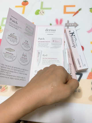 derma SC-Gel 더마에스씨 겔 20g — 4점을 준 리뷰어가 2020년 5월 올린 사용 사진