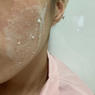 파시랩 그린 플러스 락토 버블 필링 — 5점을 준 리뷰어가 2020년 11월 올린 사용 사진
