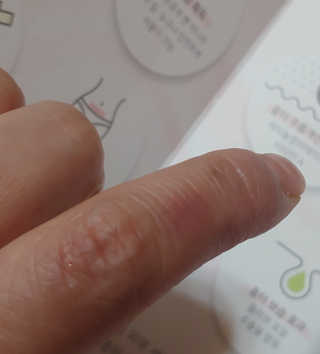 derma SC-Gel 더마에스씨 겔 20g — 5점을 준 리뷰어가 2020년 5월 올린 사용 사진