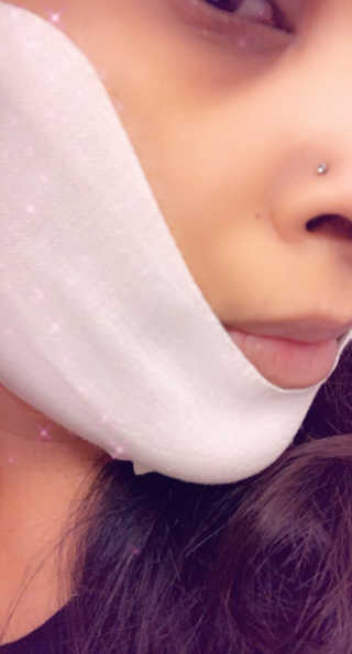 아 바자르 퍼펙트 브이 리프팅 프리미엄 액티비티 마스크 — 5점을 준 리뷰어가 2020년 12월 올린 사용 사진