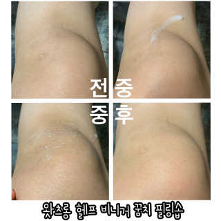 [후르디아] 문제적 바디 피부 케어_왓츠롱 2종 세트 — 5점을 준 리뷰어가 2020년 5월 올린 사용 사진