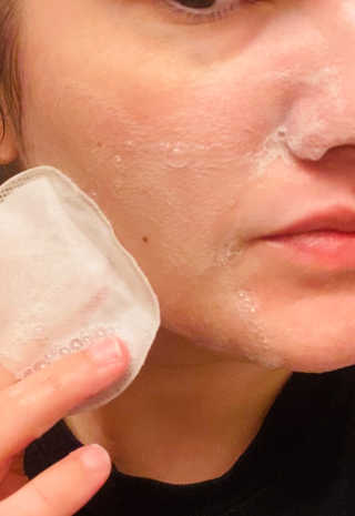 뷰트리 BEAUTREE PLA 버블 각질 제거 클렌징 패드 — 5점을 준 리뷰어가 2020년 9월 올린 사용 사진