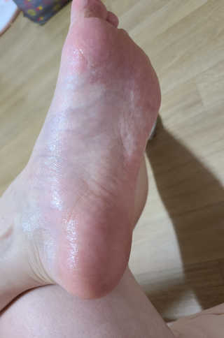 리더스코스메틱 리더스 프로 포커싱 풋 너리싱 마스크/5매 — 5점을 준 리뷰어가 2020년 9월 올린 사용 사진