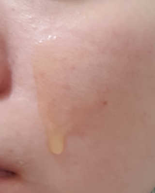 미구하라 프리미엄 울트라 화이트닝 퍼펙트 앰플 오리진  20ml — 5점을 준 리뷰어가 2020년 4월 올린 사용 사진