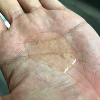 에이처드 유산균 탈모 샴푸 500ml — 5점을 준 리뷰어가 2020년 9월 올린 사용 사진