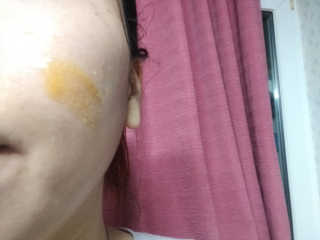메디페르 루테인앰플 10ml 4개 — 5점을 준 리뷰어가 2020년 4월 올린 사용 사진