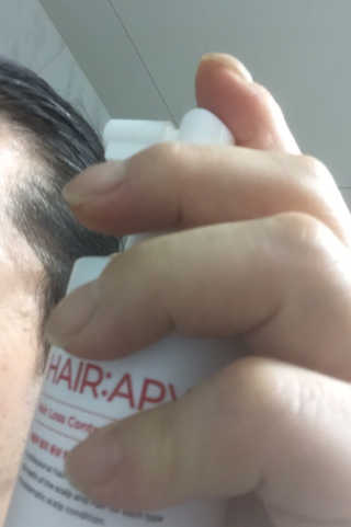 리더스코스메틱 리더스 헤어 라피 헤어 로스 컨트롤 토닉 — 5점을 준 리뷰어가 2020년 8월 올린 사용 사진