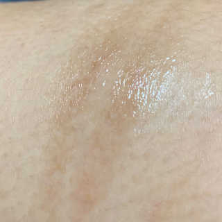derma SC-Gel 더마에스씨 겔 20g — 4.5점을 준 리뷰어가 2020년 4월 올린 사용 사진
