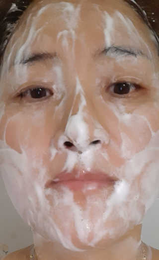 메디필 에스테 더마 유산균 콜라겐 클리어 — 4점을 준 리뷰어가 2020년 5월 올린 사용 사진