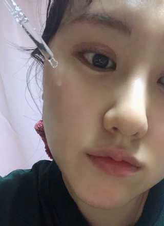 [스킨큐어] 산다화 비타민C 화이트닝 에센스 30ml — 5점을 준 리뷰어가 2020년 4월 올린 사용 사진