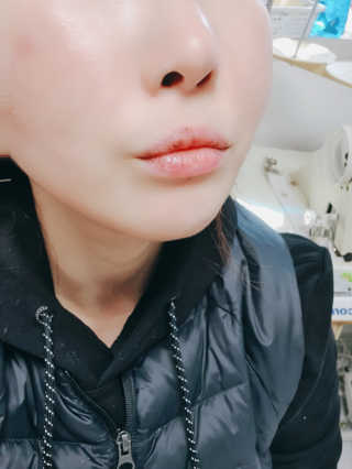 yumegom님이 올린 리뷰 사진 1