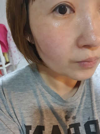 뷰니오 더마플러스 카밍 에멀전200ml — 5점을 준 리뷰어가 2020년 12월 올린 사용 사진