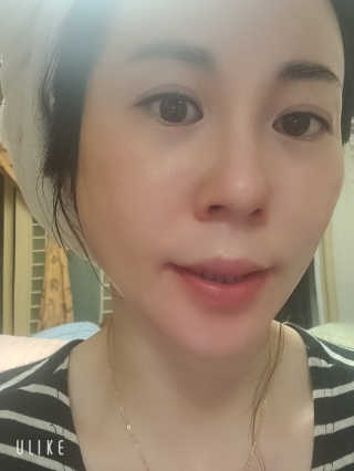 페네그린 고농축 저자극 원액앰플 — 5점을 준 리뷰어가 2020년 8월 올린 사용 사진