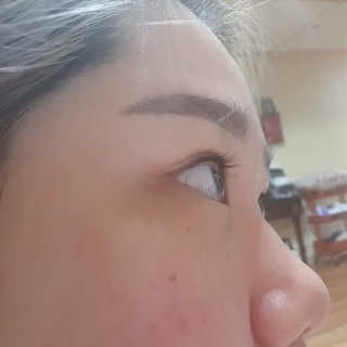 엘라밴드 하이드로 도트 스팟패치 12mm, 티트리 — 5점을 준 리뷰어가 2020년 8월 올린 사용 사진