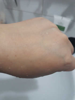 메디필 에스테 더마 유산균 콜라겐 클리어 — 5점을 준 리뷰어가 2020년 8월 올린 사용 사진