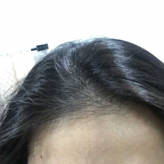 달리프 클로렐라 베러 루트 헤어토닉 100ml — 5점을 준 리뷰어가 2020년 11월 올린 사용 사진