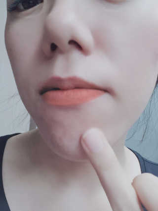 히루스카 포스트아크네 클리어 — 4점을 준 리뷰어가 2020년 12월 올린 사용 사진