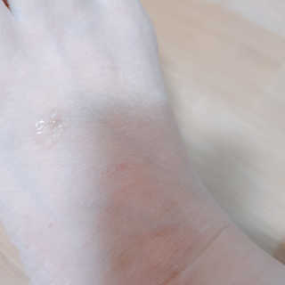 derma SC-Gel 더마에스씨 겔 20g — 5점을 준 리뷰어가 2020년 4월 올린 사용 사진