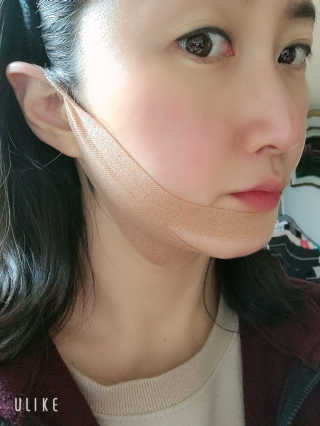 아이디플라코스메틱 아이디 페이스핏 마이너스 밴드 v2 — 5점을 준 리뷰어가 2020년 12월 올린 사용 사진
